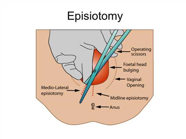 Когда обратиться за помощью